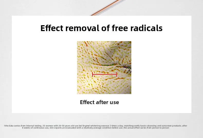 Niacinamide Serum for Dark Spots, Brightening Skin, Moisturizing