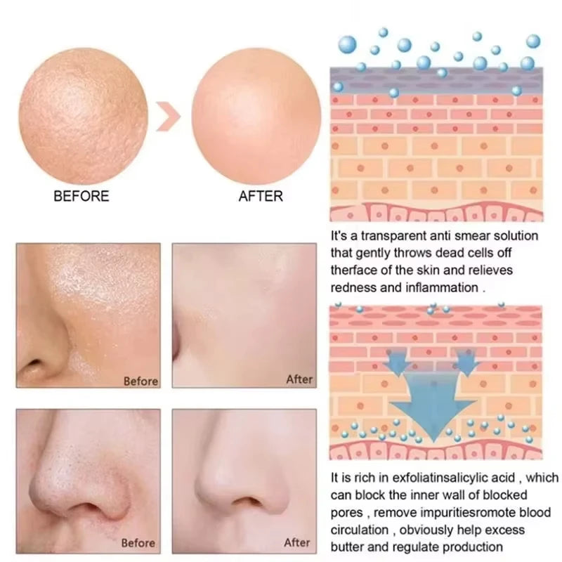 Serum Se Khít Lỗ Chân Lông, Săn Da, Mịn Màng Hàn Quốc