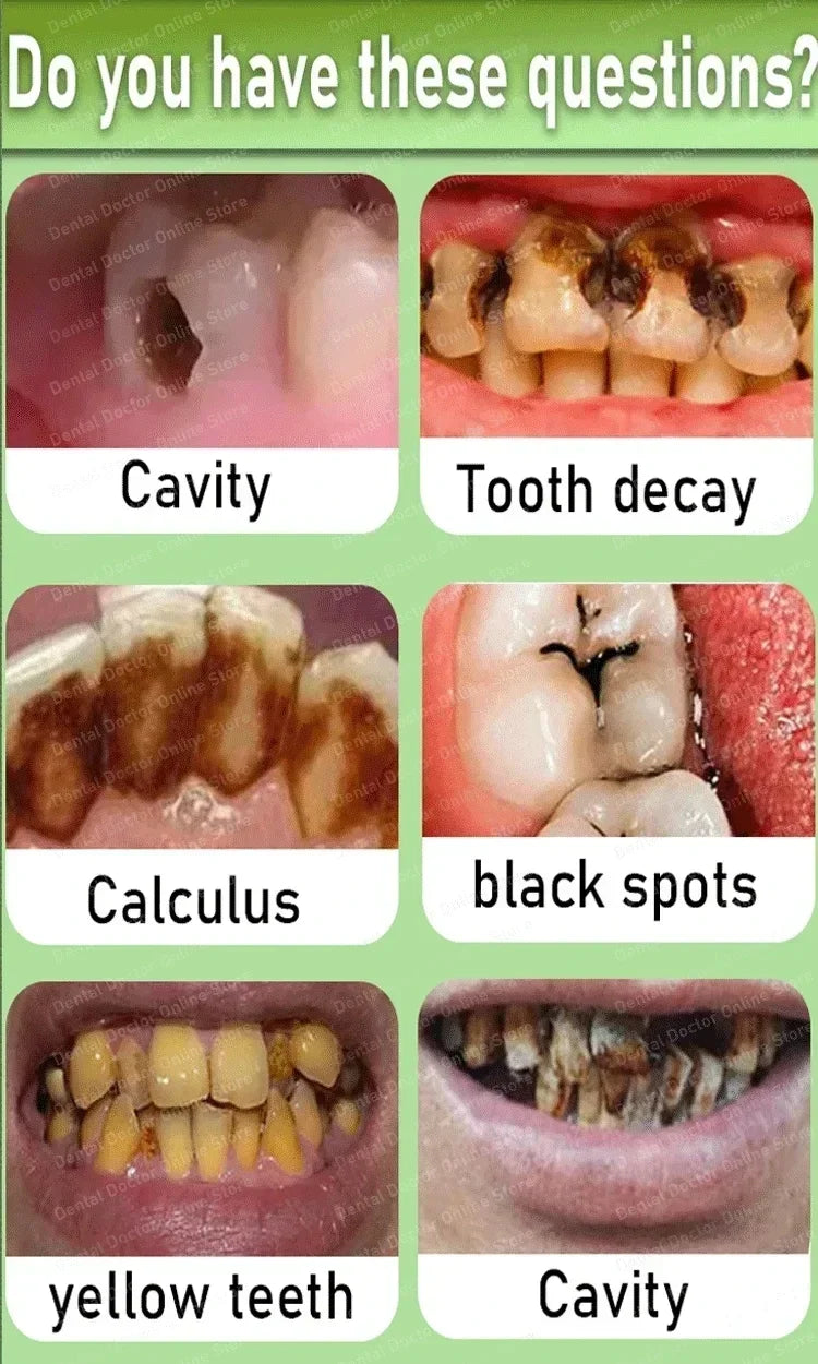 Anti Decay Toothpaste repairs cavities, removes cavities, cleans plaque, whitens teeth, and freshens breath - Daisan Mart
