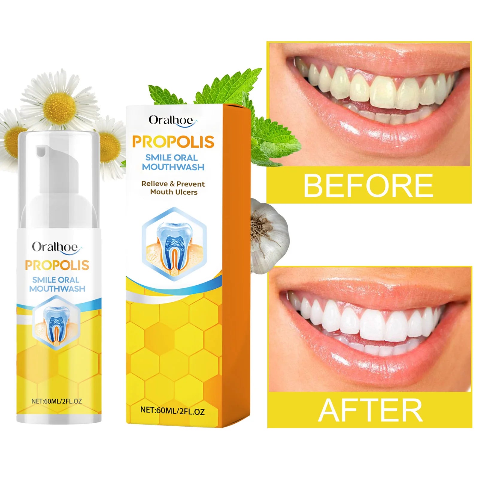 Nước Súc Miệng Propolis Smile Trắng Răng Sạch Mảng Bám - Daisan Mart