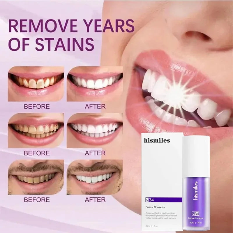 30ml V34 SmileKit Purple Toothpaste Removes Tartar Clean Oral Hygiene Fresh Breath Whitening Teeth Care Products - Daisan Mart
