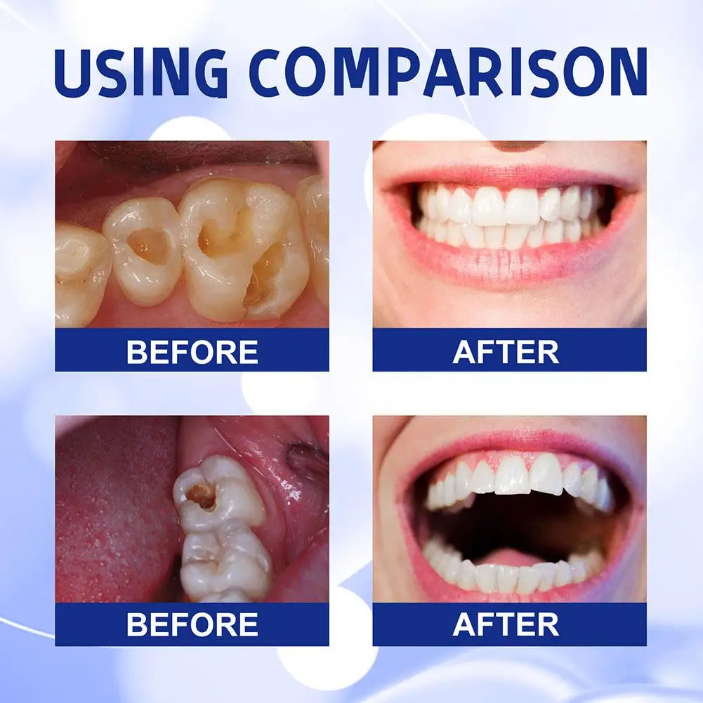 Anti Decay Toothpaste Dental Caries Repair Cream Prevent Tooth Decay Protect TeethDeep Clean Whitening & Fresh Breath Toothpast - Daisan Mart