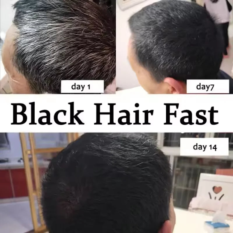 Serum for Natural Black Hair Restoration &amp; Hair Loss Prevention