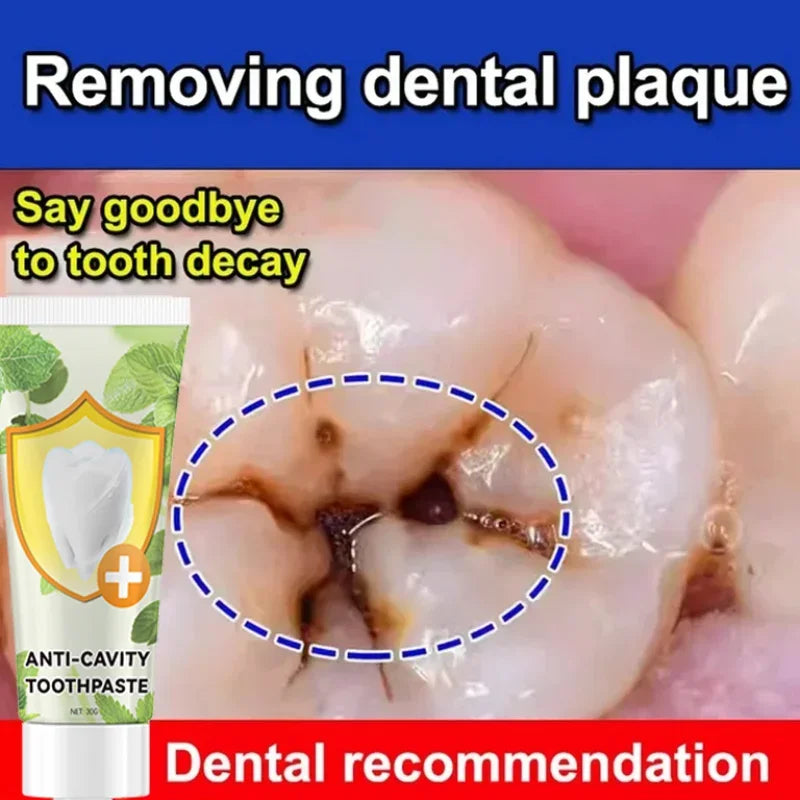 Anti Decay Toothpaste repairs cavities, removes cavities, cleans plaque, whitens teeth, and freshens breath - Daisan Mart