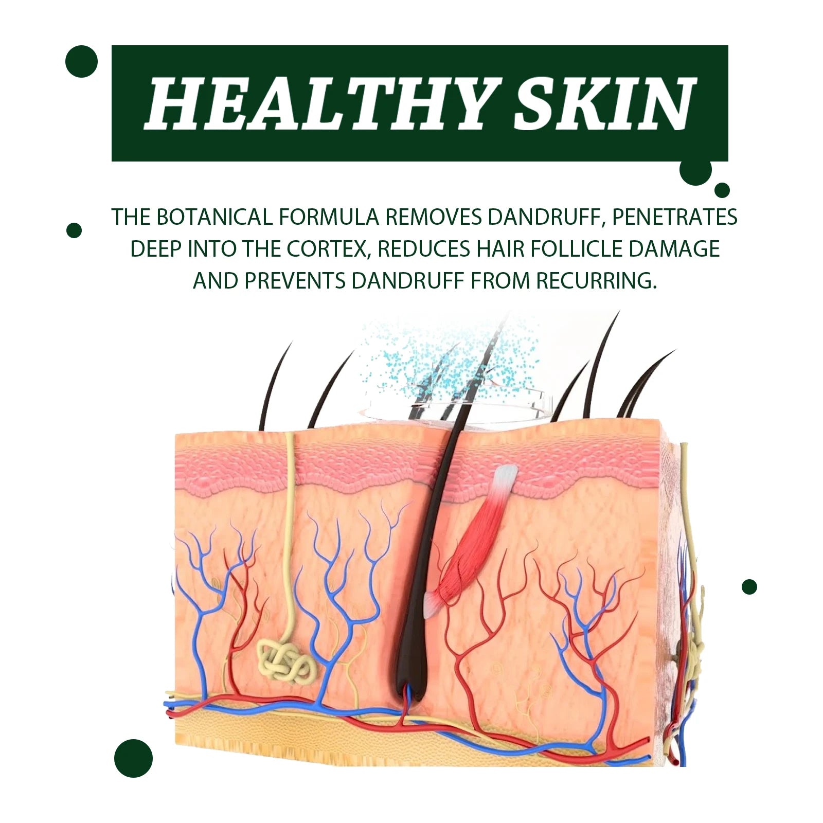 Anti-Dandruff Shampoo, Moisturizing &amp; Scalp Restoration