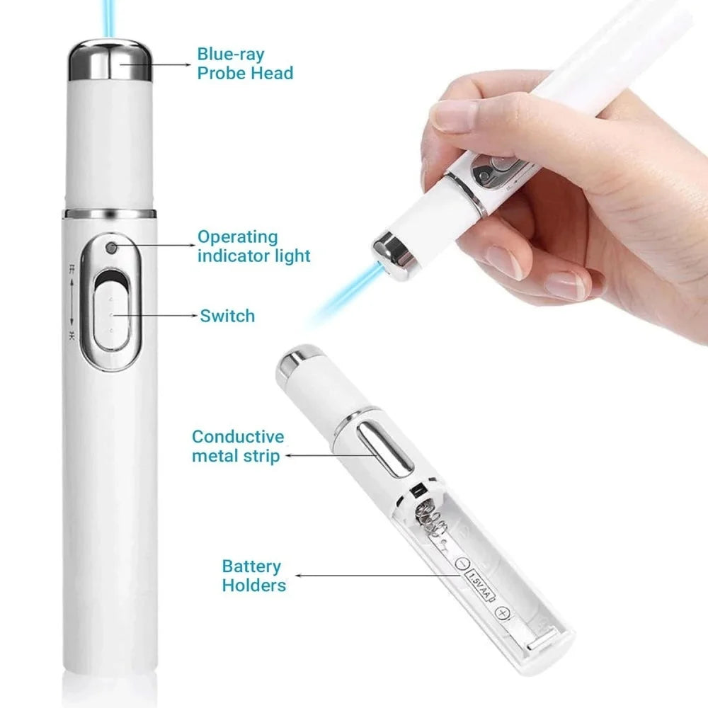 Blue Light Vibrating Eye Massager to Reduce Dark Circles