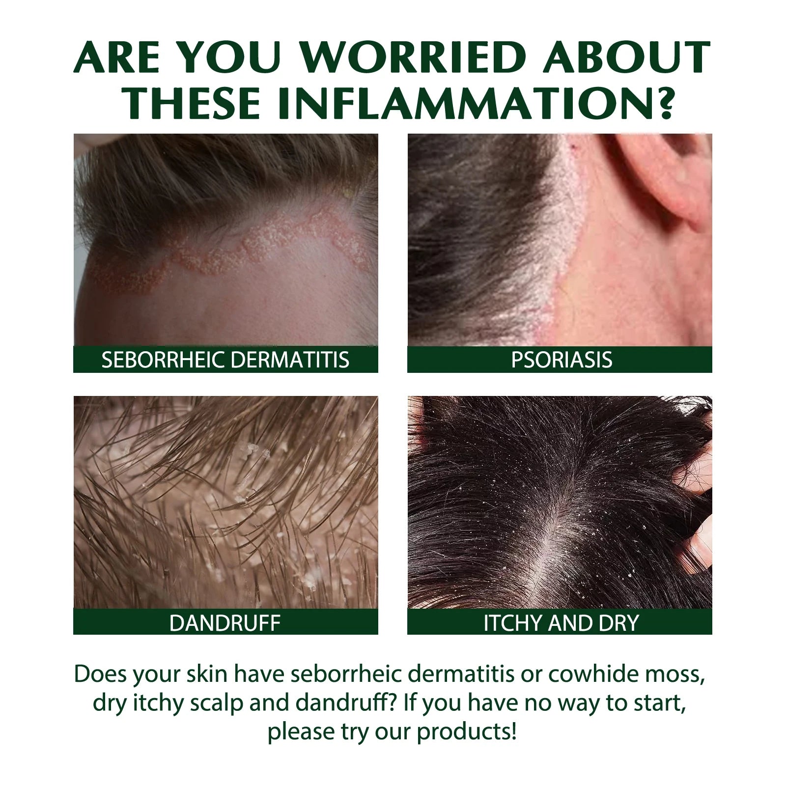 Anti-Dandruff Shampoo, Moisturizing &amp; Scalp Restoration