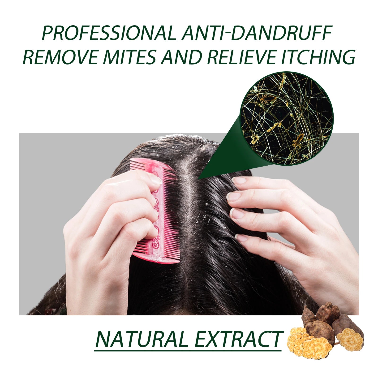 Anti-Dandruff Shampoo, Moisturizing &amp; Scalp Restoration