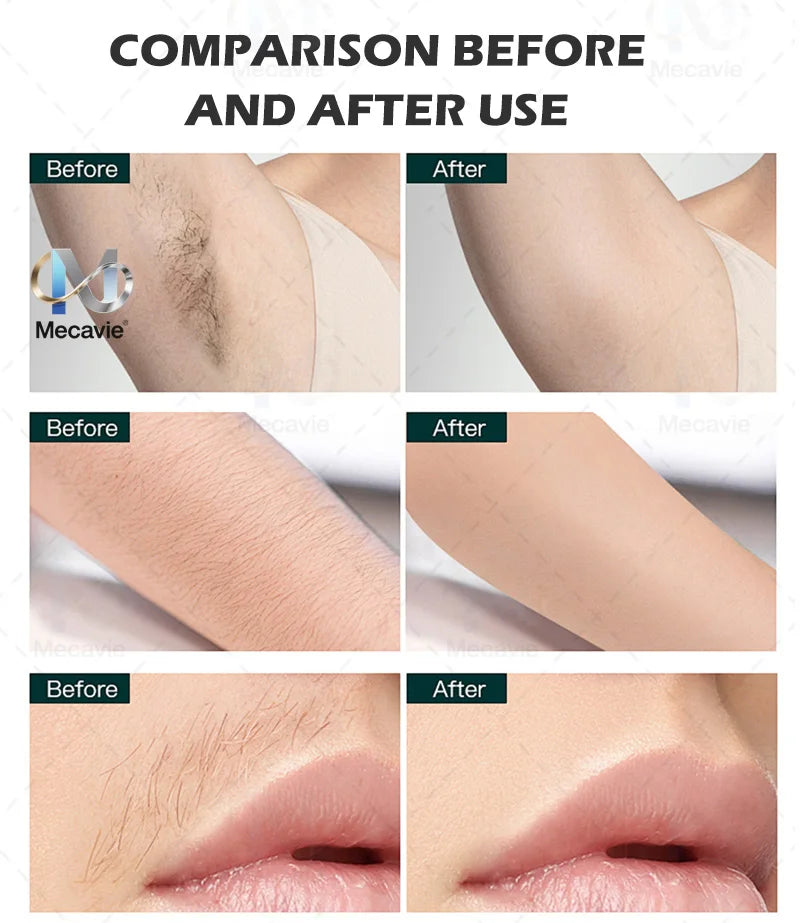 New 808nm Diode Laser Hair Removal Machine 4Wavelength Permanent Painless Physical Underarm Body Care Depilation Equipment