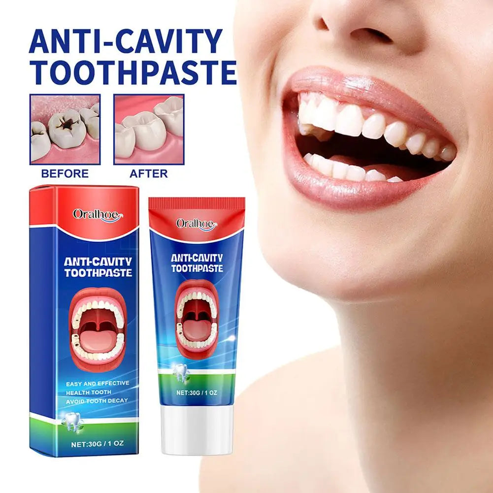 Anti Decay Toothpaste Dental Caries Repair Cream Prevent Tooth Decay Protect TeethDeep Clean Whitening & Fresh Breath Toothpast - Daisan Mart