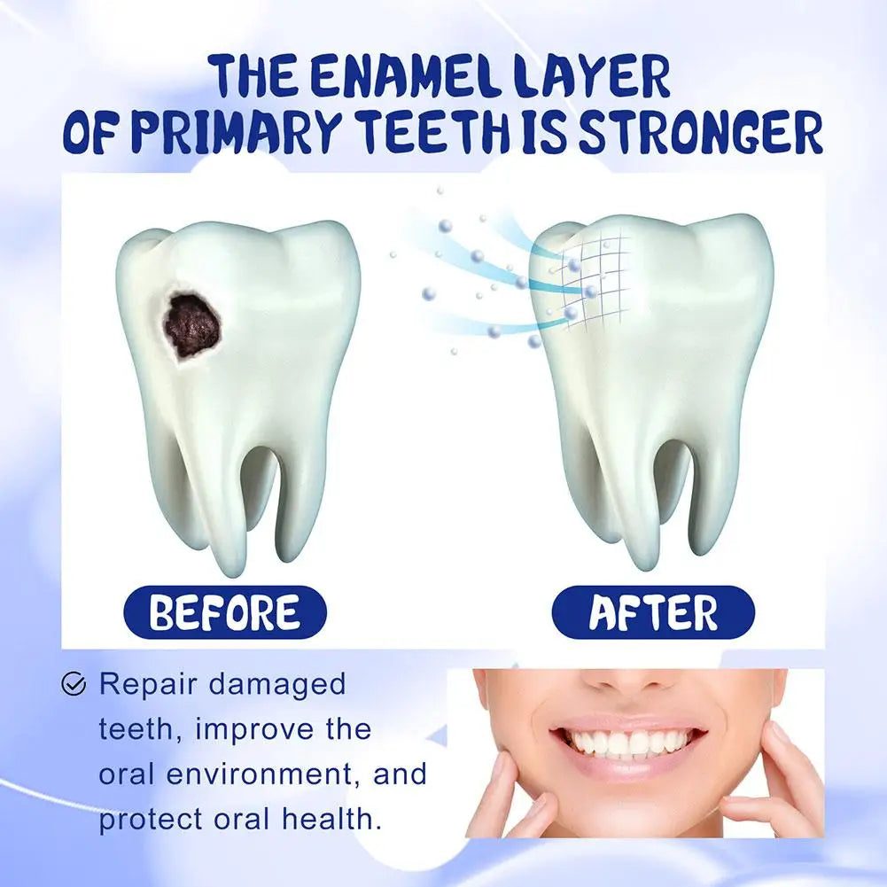 Anti Decay Toothpaste Dental Caries Repair Cream Prevent Tooth Decay Protect TeethDeep Clean Whitening & Fresh Breath Toothpast - Daisan Mart