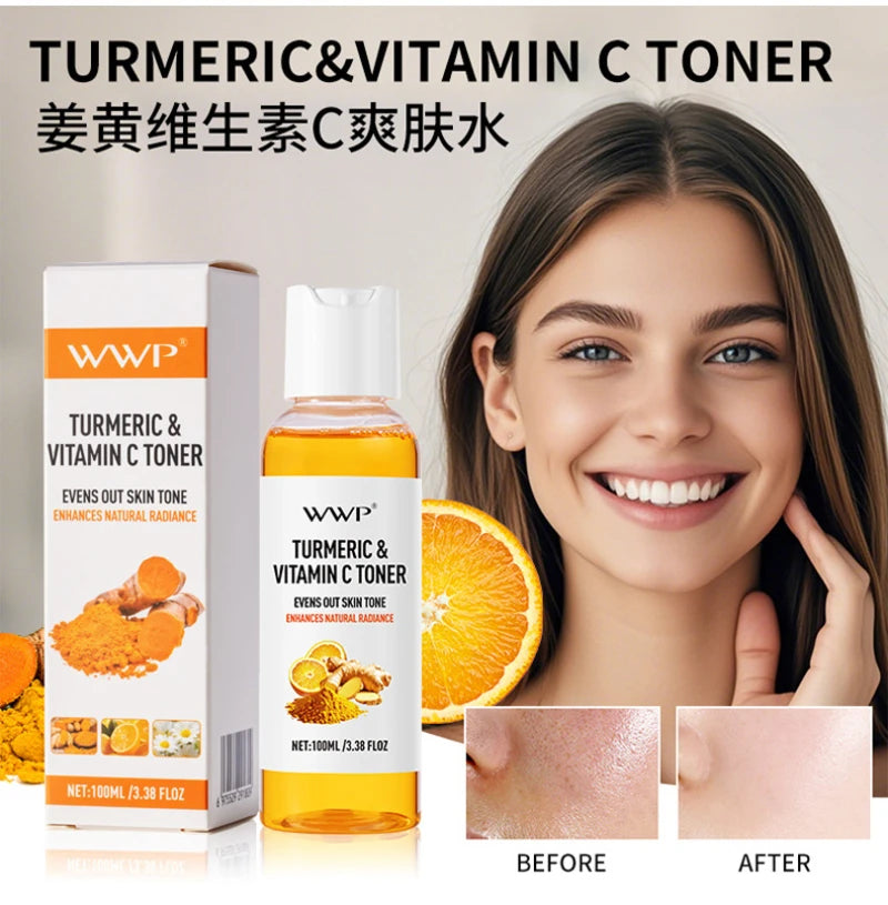 Turmeric Vitamin C Toner-Turmeric Antioxidant Refreshing &amp; Moisturizing,Brightens &amp; Softens Face Care Toner for All Skin Types