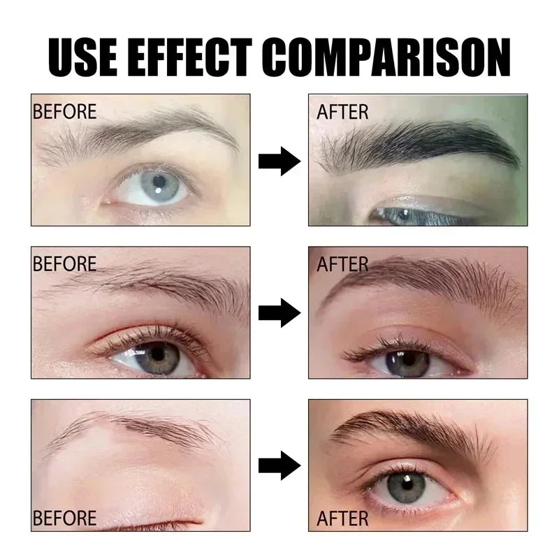 Eyebrow &amp; Eyelash Growth Serum - Anti-Hair Loss