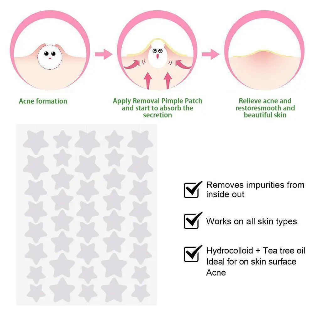 7PS Color Invisible Acne Removal Star Pimple Patch Facial Acne Spot Cover Concealer Invisible Color Patch Spot Scar Care Sticker - Daisan Mart