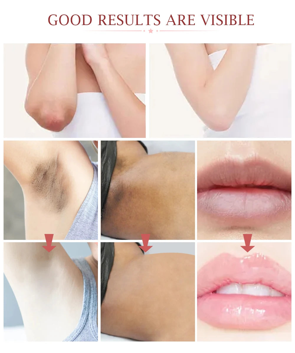 Whitening Cream for Sensitive Skin, Natural Brightening