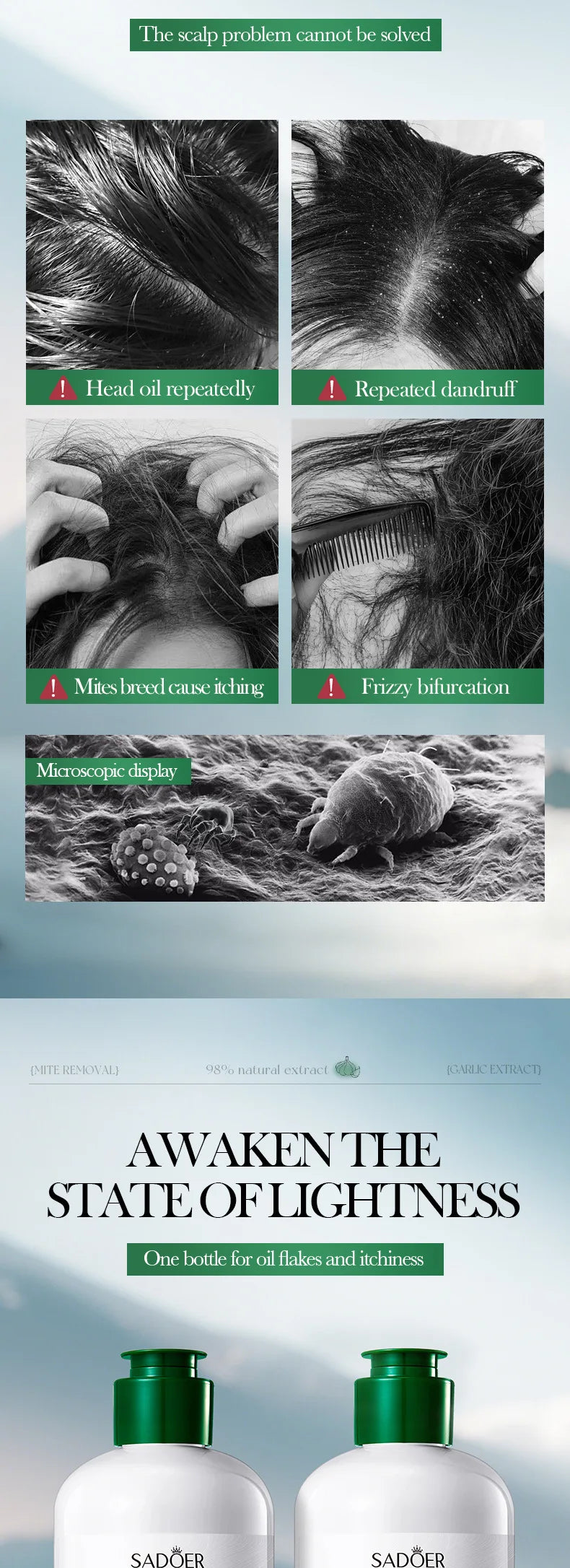 SADOER shampoo soothes itching, removes dandruff, and controls oil