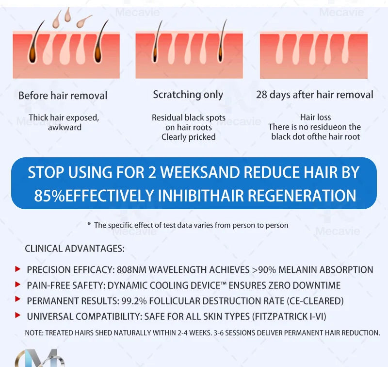 New 808nm Diode Laser Hair Removal Machine 4Wavelength Permanent Painless Physical Underarm Body Care Depilation Equipment