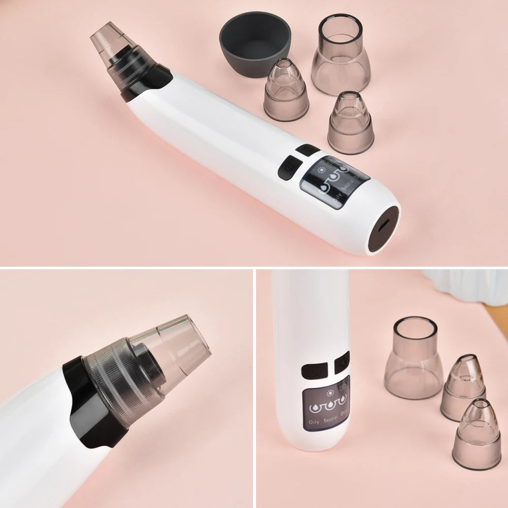 Blackhead Remover &amp; Home Skin Care