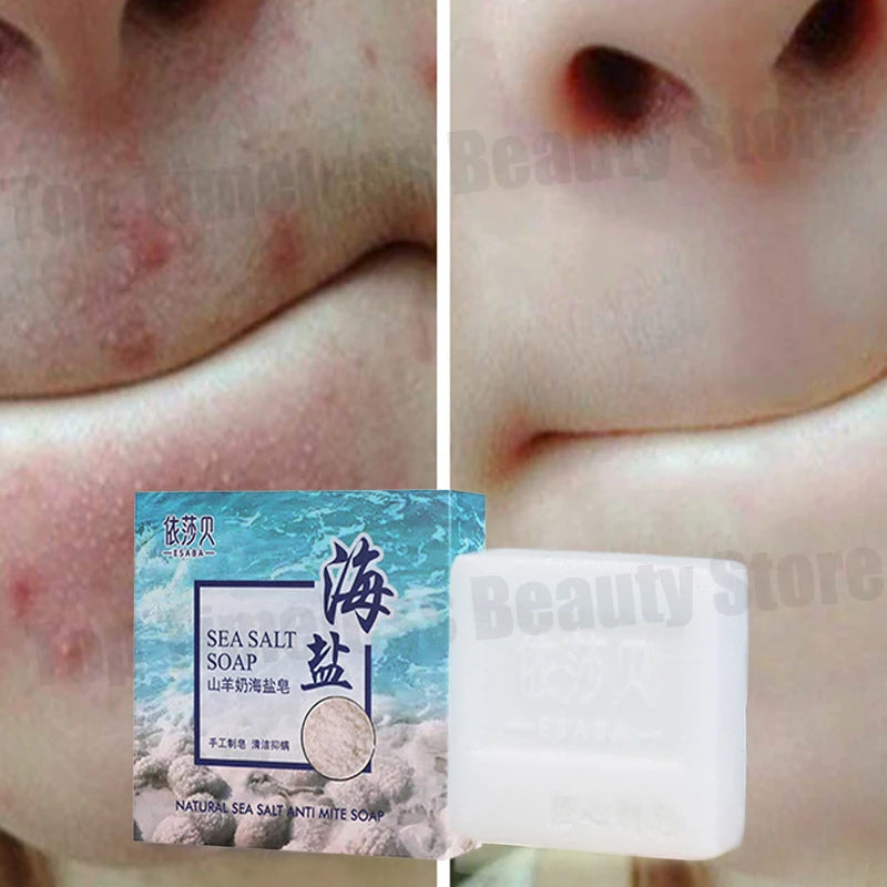 Sea Salt Body Acne Removal Soap Treatment Face Butt Back Acne Marks Smooth Repair Chicken Skin Moisturizing Whitening Skin Care