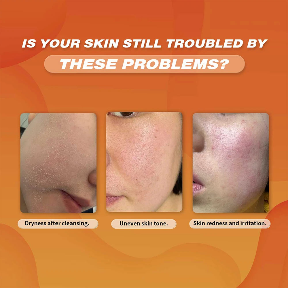 Turmeric Face Cleanser + Turmeric Kojic Acid Facial Exfoliating Cleansing Pads Reduce Dark Spots Skin Brightening Face Care Set