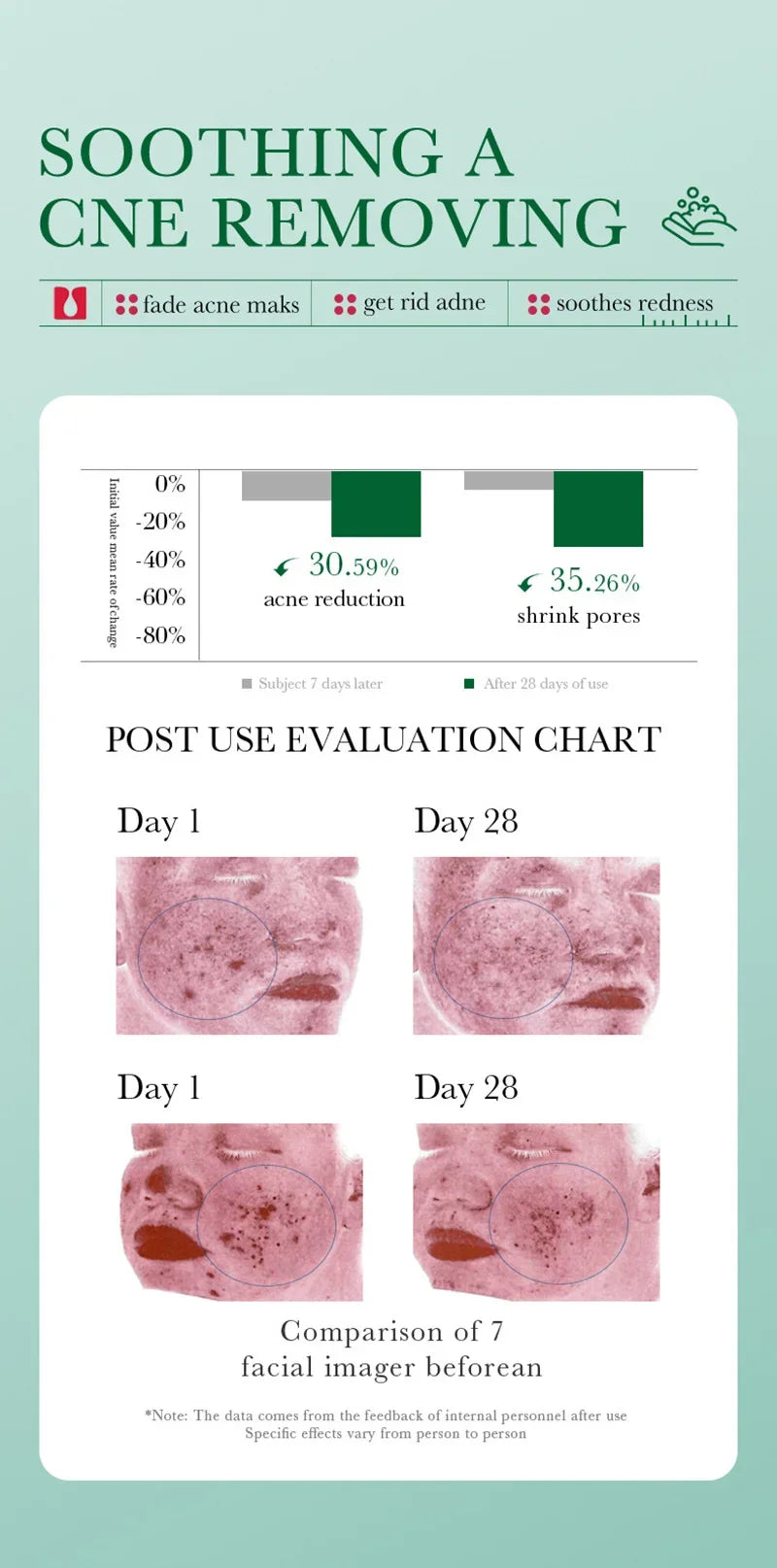 BIOAOUA Salicylic Acid Ance Removal Cleanser Fade Ance Marks Mild Moisturizing Soothing Facial Cleanser Face Washing Products