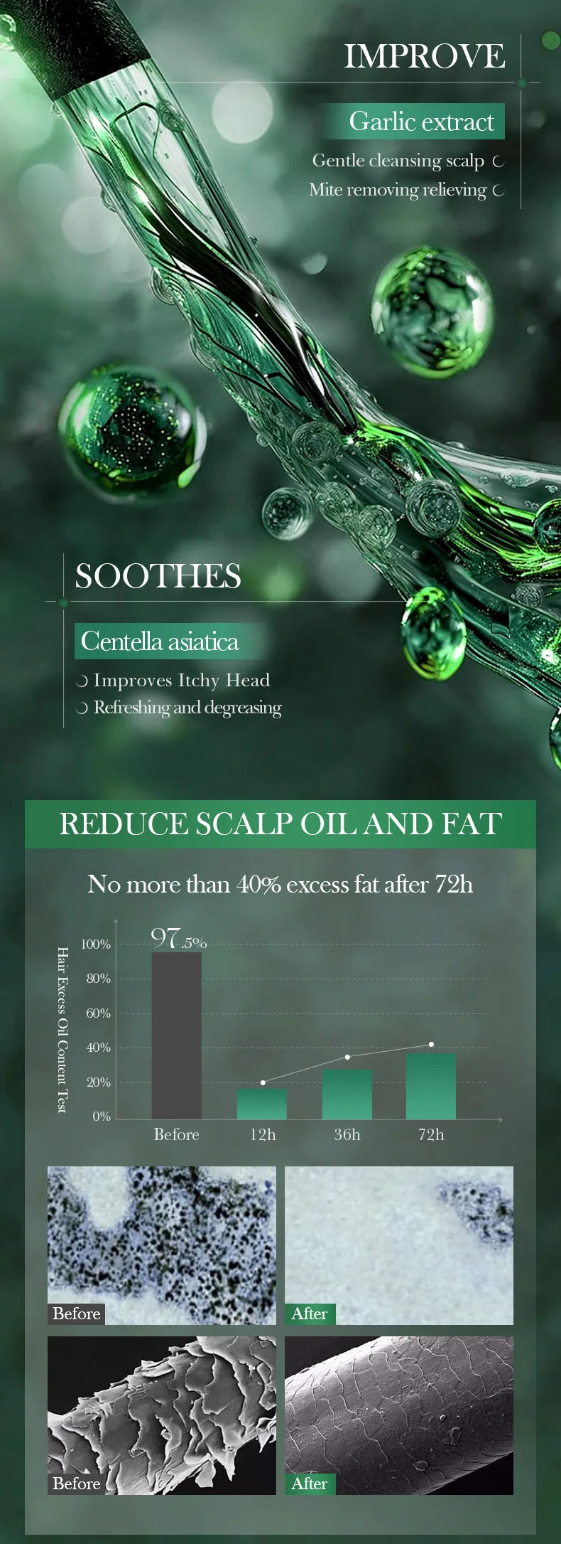 SADOER shampoo soothes itching, removes dandruff, and controls oil