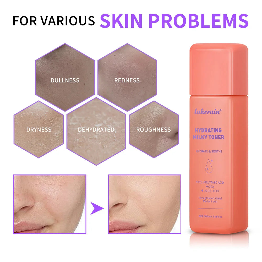 Hydrating Milky Toner Repair Skin Ultra Hydrating Toner for Face Soothes Skin Moisture Reduces Redness Barrier Skincare