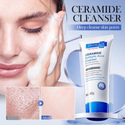 Salicylic Acid Cleansing Facial Cleanser Oil Control Anti-Acne Skin Care Whitening Cleanser Gentle Mild Facial Cleanser