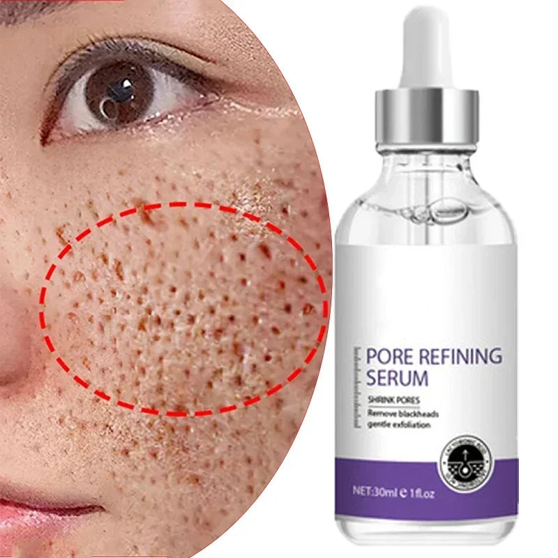Skin Texture | Pore ​​Refining Resurfacing, Brightening Facial Serum with Retinol and Niacinamide Non-Comedogenic