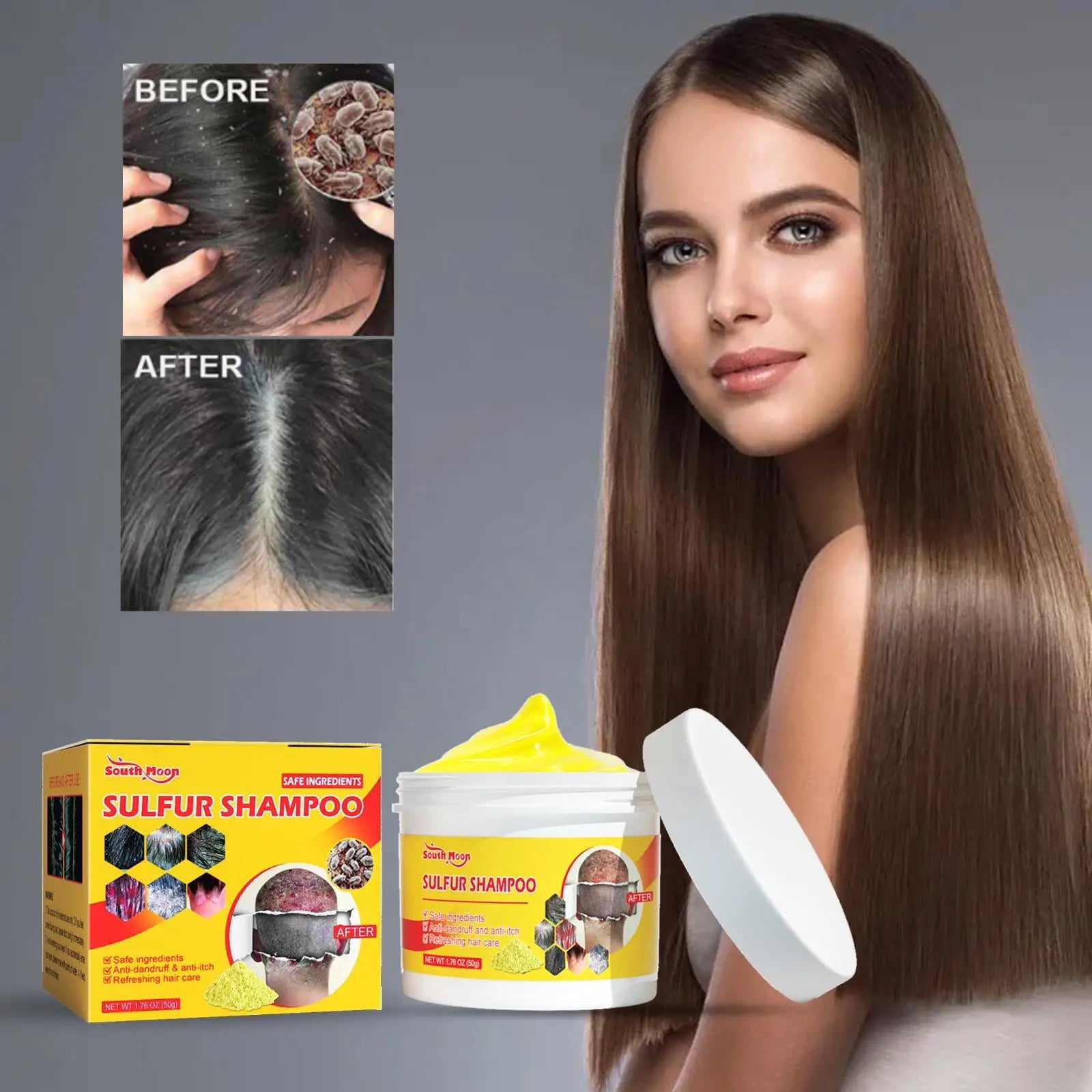 Dầu gội lưu huỳnh 50g trị chấy, nấm, gàu, ngứa