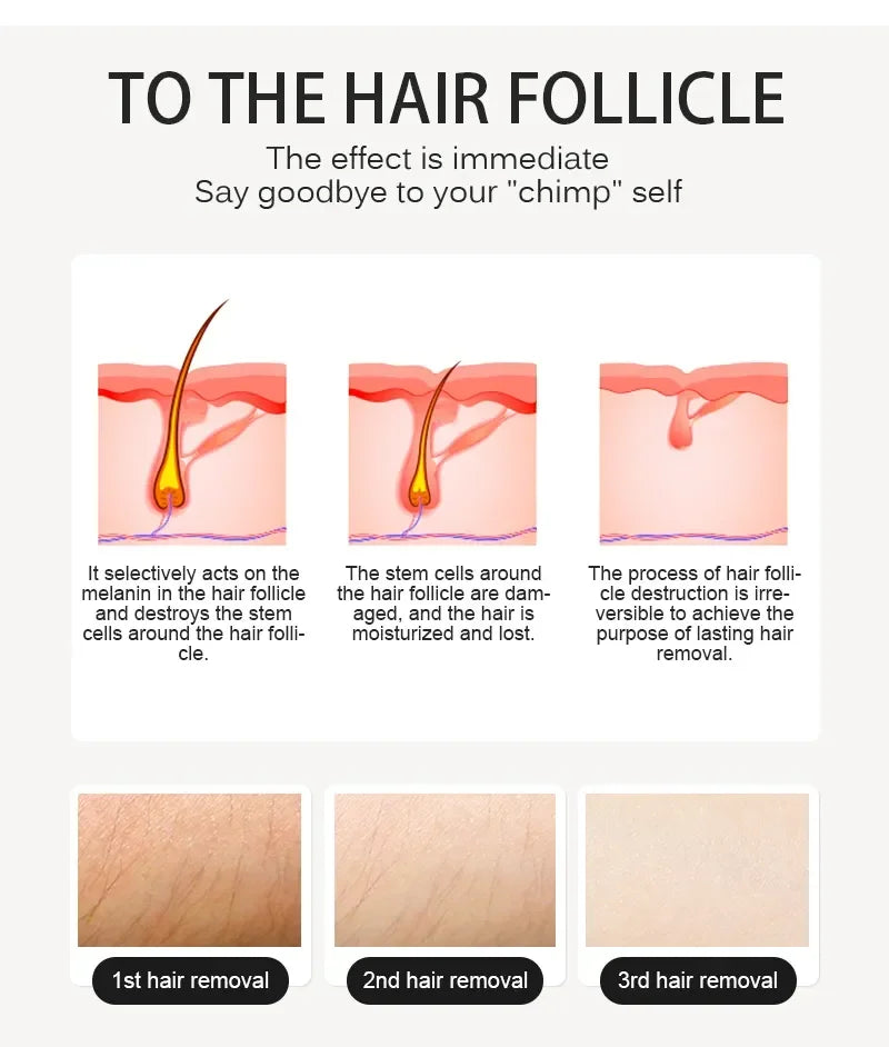 2025 Portable 3 Wave 808 755 1064nm Ice Titanium Professional 808nm Diode Laser Body Face Hair Removal Machine