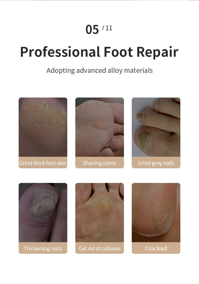 Electric Foot Grinder Automatic Foot Callus Rubbing Pedicure Dead Skin Callus Remover for Foot Rechargeable Foot Beauty Machine