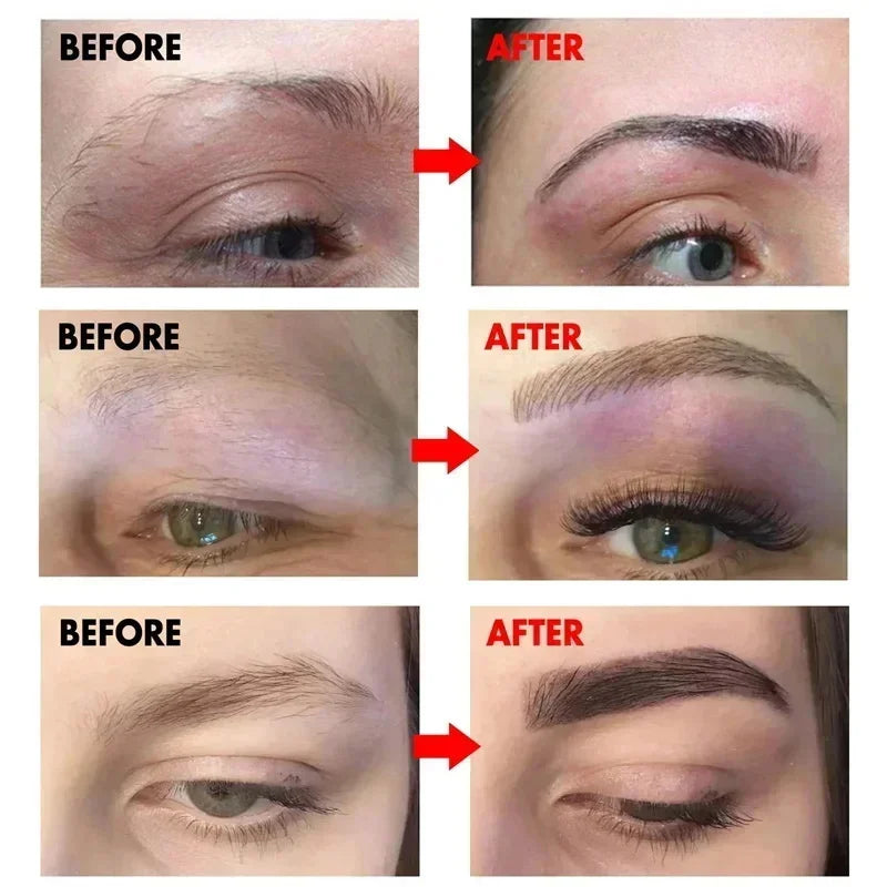 Eyebrow &amp; Eyelash Growth Serum - Anti-Hair Loss