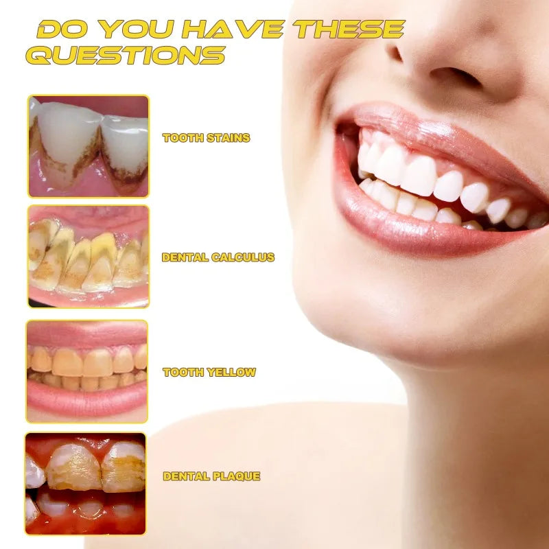 Nước Súc Miệng Propolis Smile Trắng Răng Sạch Mảng Bám - Daisan Mart