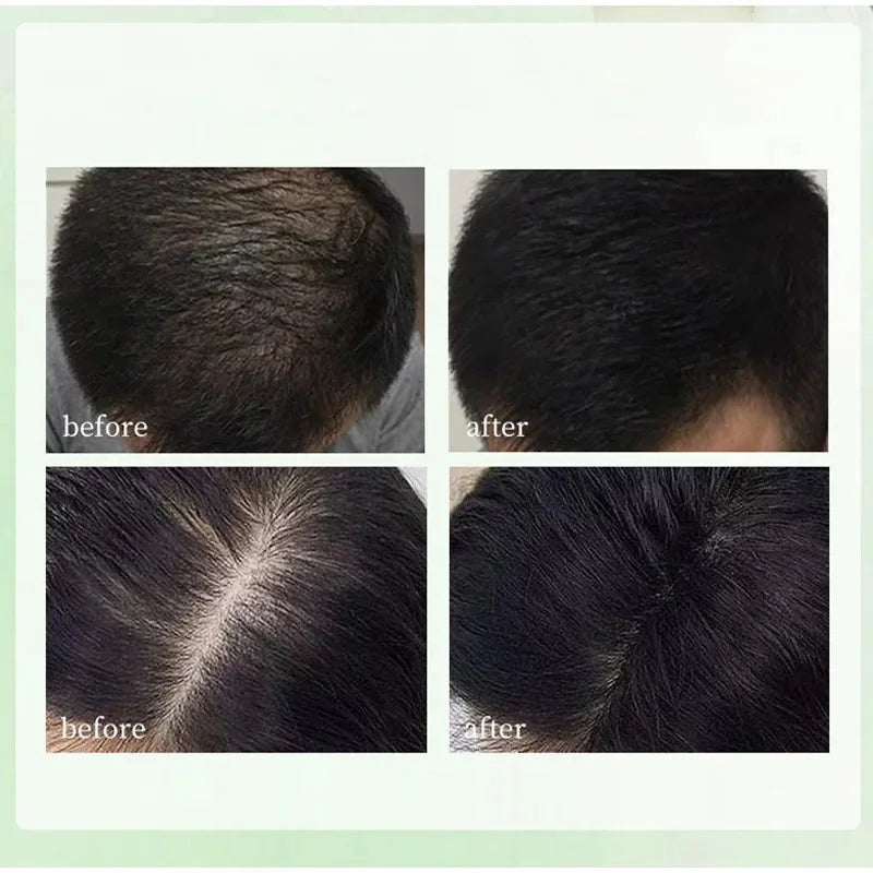 Platycladus Herbal Shampoo for Natural Hair Loss Prevention