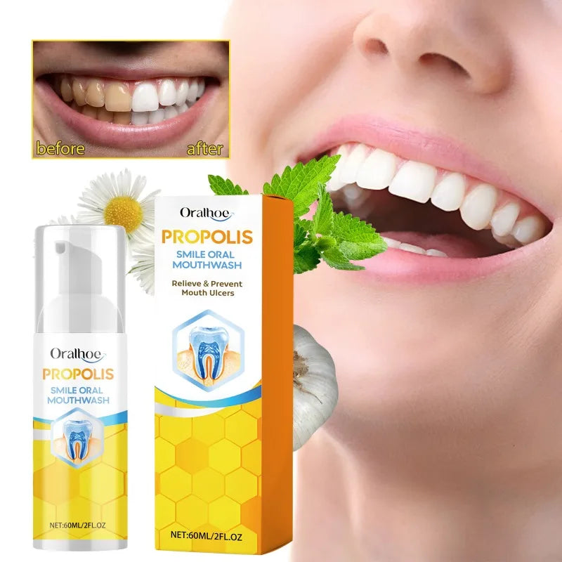 Nước súc miệng Propolis với nền trắng, hộp màu vàng và ảnh người cười trắng sáng.