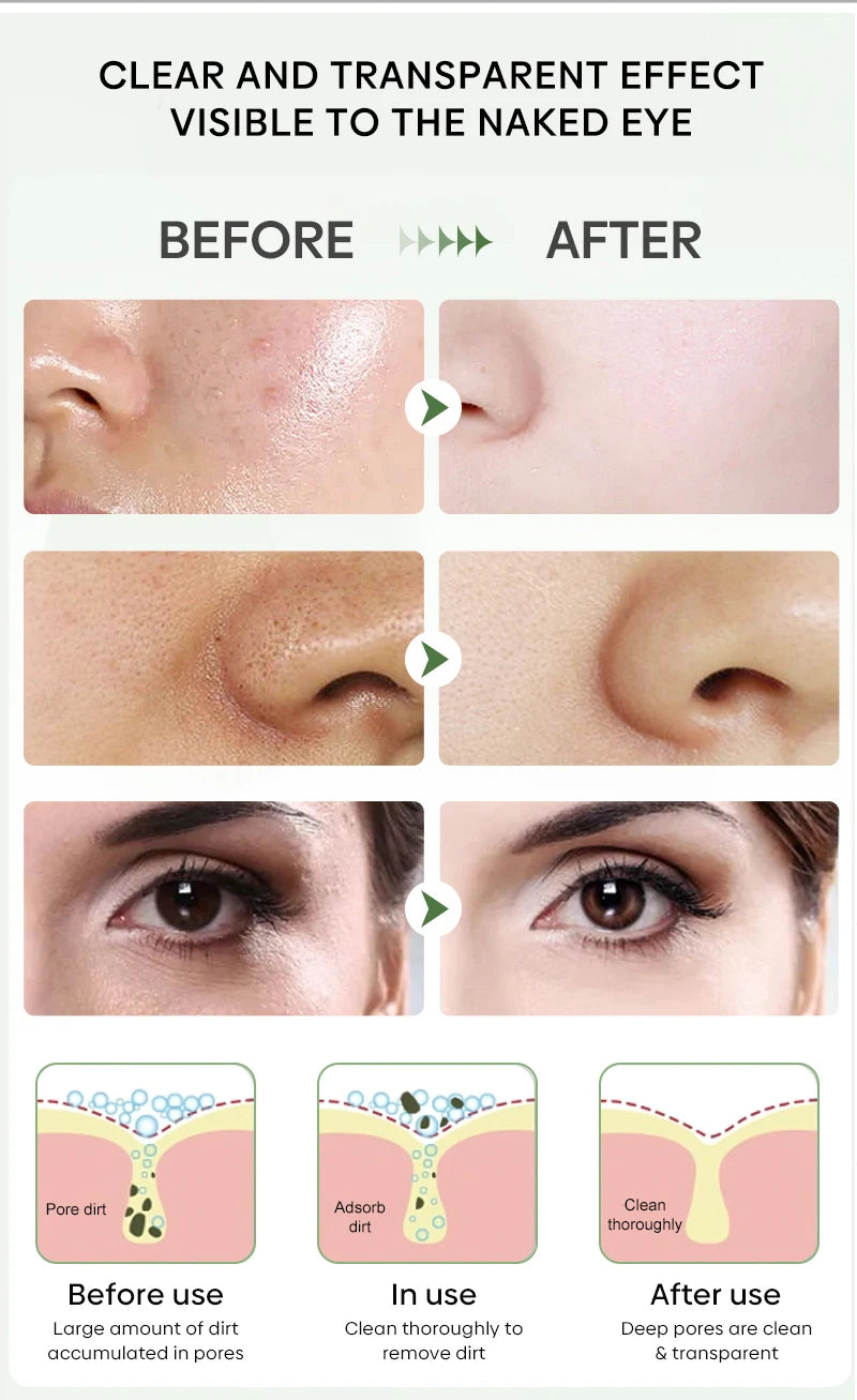 Green Tea Mask for Blackheads &amp; Pore Tightening