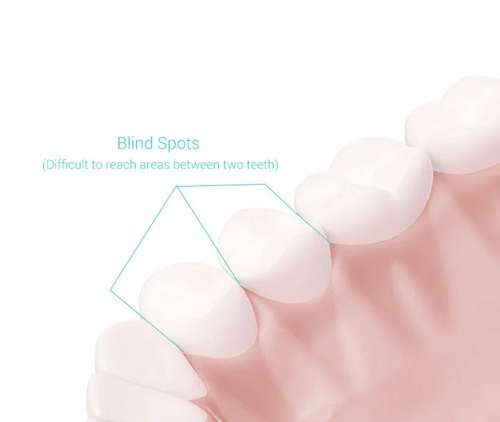 Bàn chải điện MIJIA T300 - Sạc 25 ngày, 2 chế độ