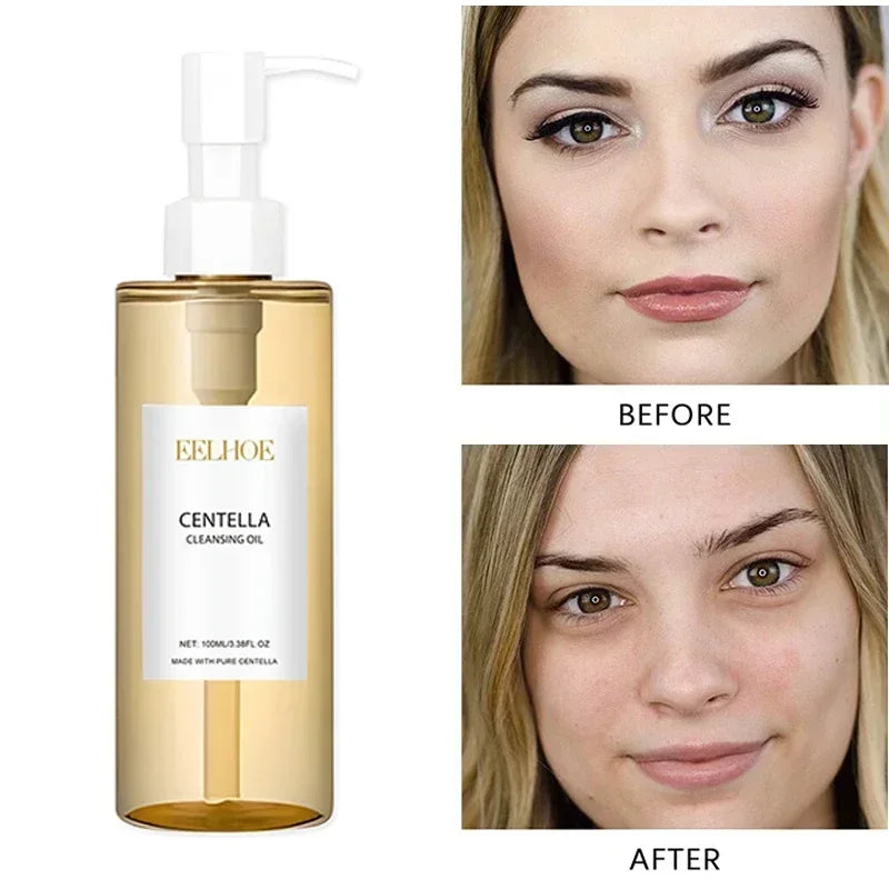 Centella Face Refreshing Foaming Cleanser,Gentle Removes Dirt,Oil Control Deep Cleansing Calming Ampoule Foam,Korean Skincare