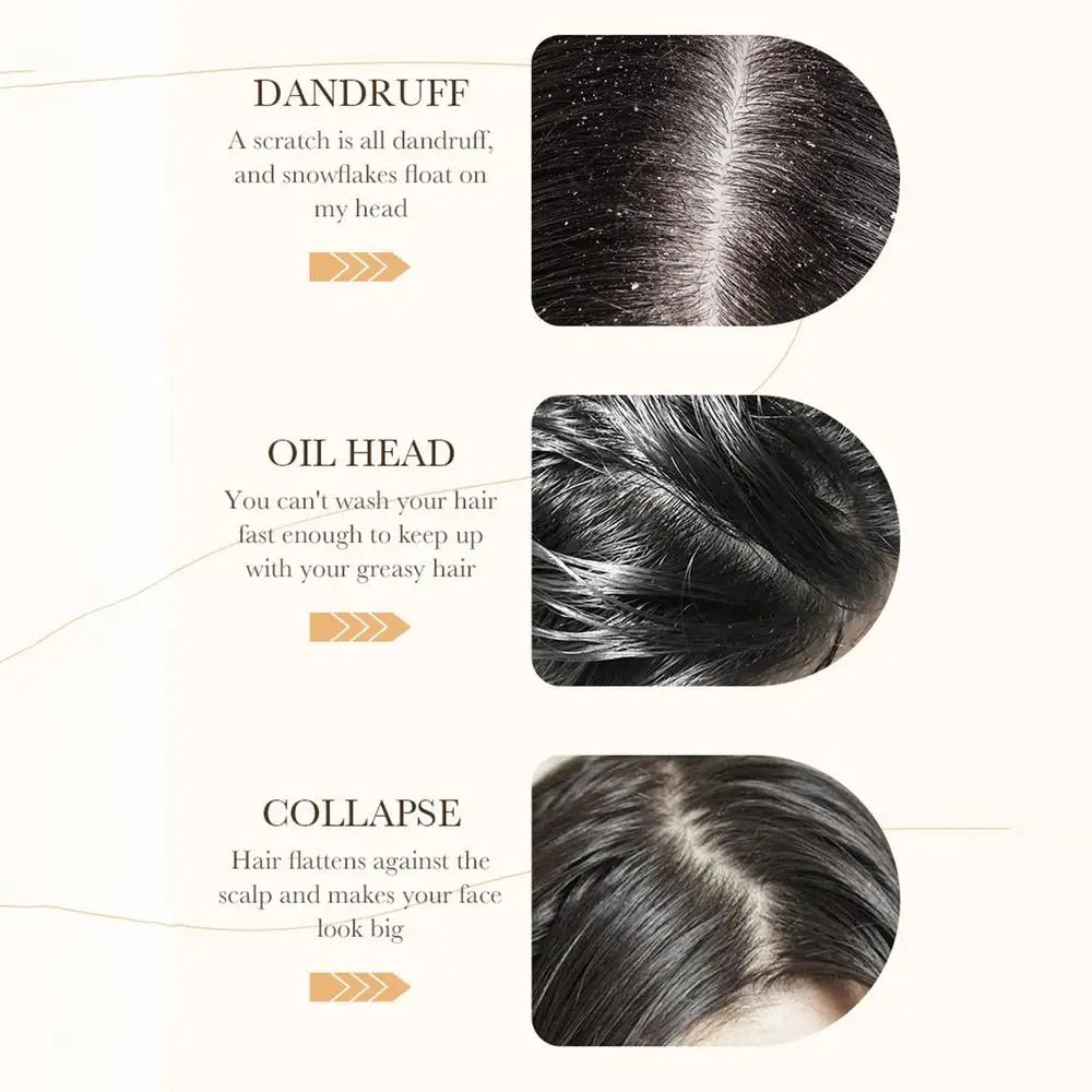 Dầu Gội Dưỡng Tóc Gạo - Dưỡng Ẩm & Phục Hồi Tóc Yếu