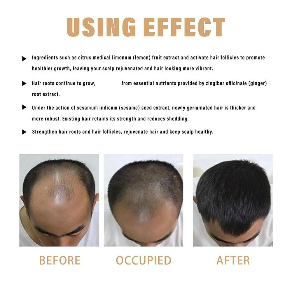 Dầu Gội Phục Hồi & Kích Thích Mọc Tóc Dày Khỏe