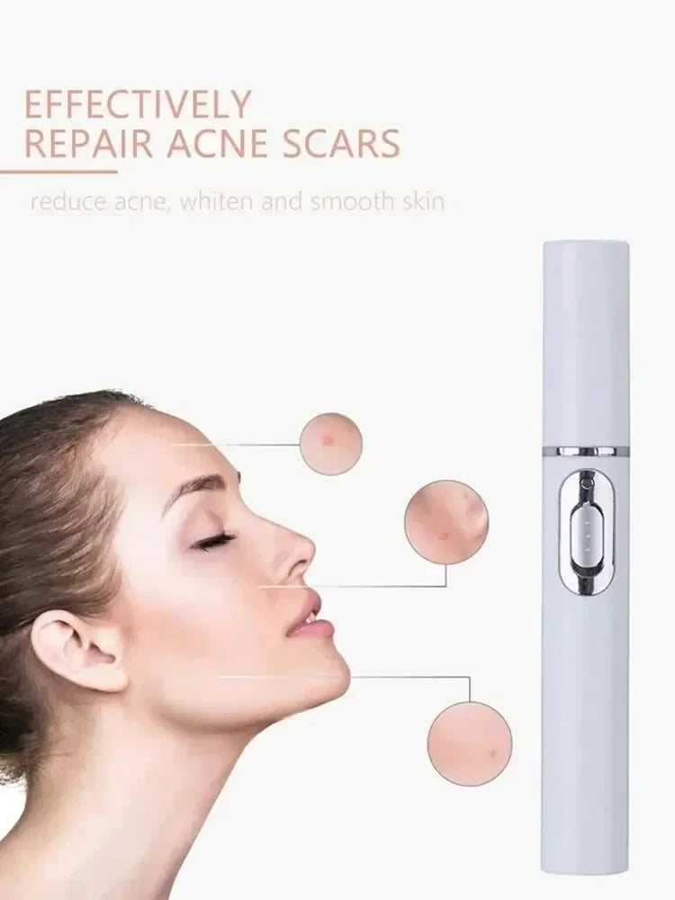 Máy Massage Mắt Rung Ánh Sáng Xanh Giảm Thâm Bọng - Daisan Mart