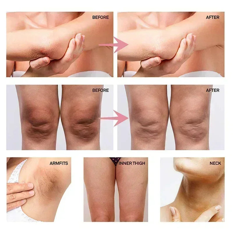 Kem Dưỡng Trắng Ẩm Vùng Kín, Nách, Đầu Gối, Làm Sáng Da - Daisan Mart