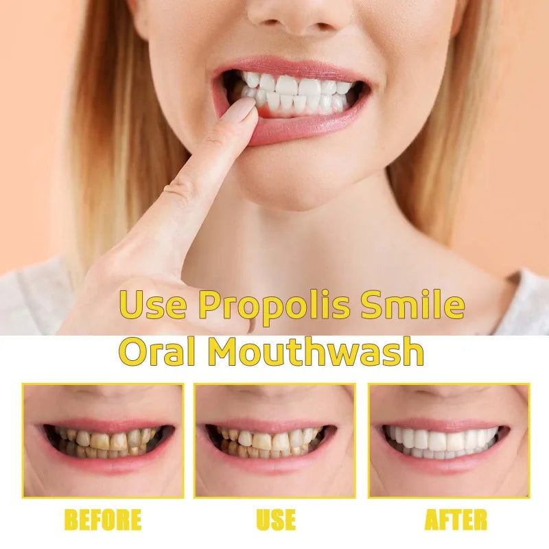 Nước Súc Miệng Propolis Smile Trắng Răng Sạch Mảng Bám - Daisan Mart