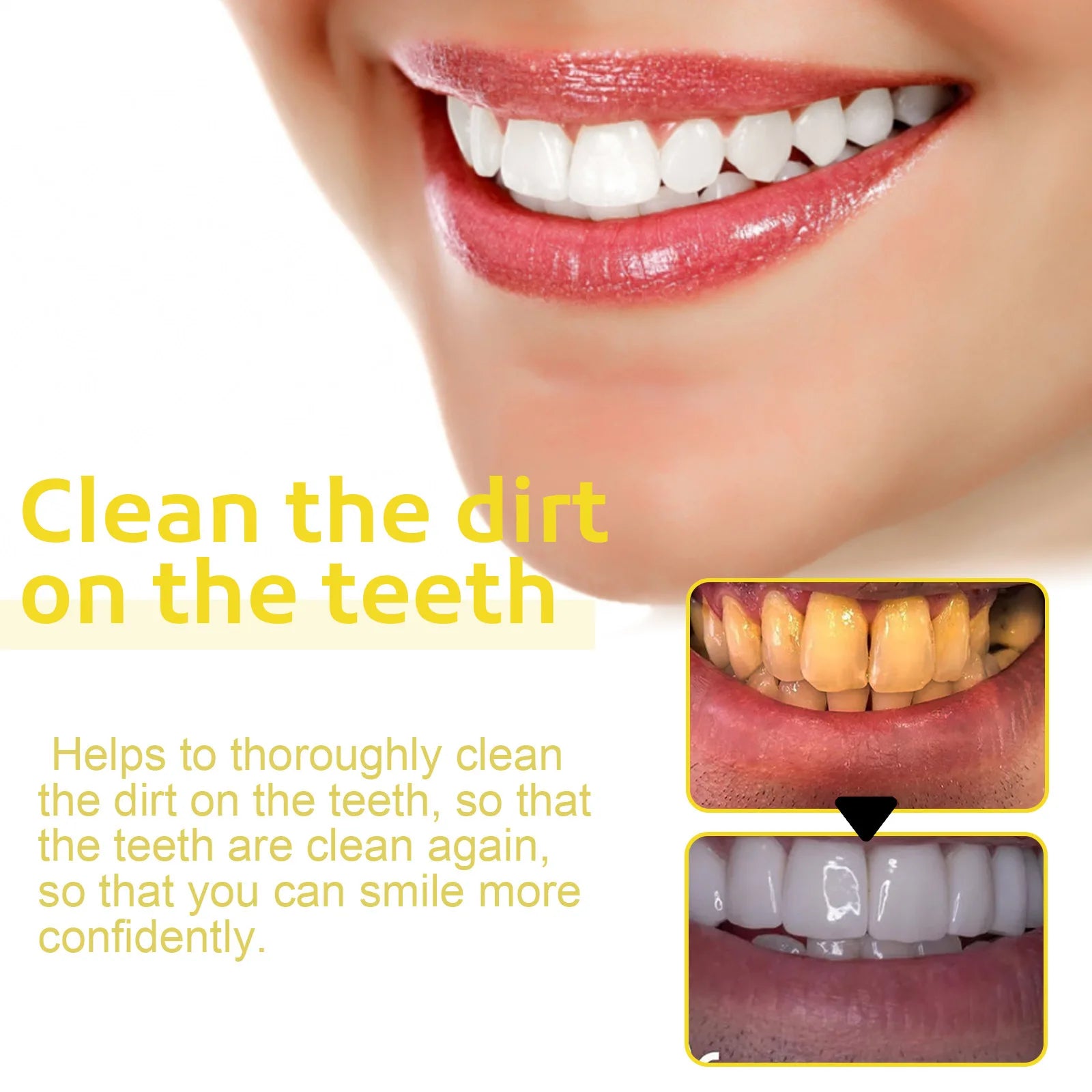 Nước Súc Miệng Propolis Smile Trắng Răng Sạch Mảng Bám - Daisan Mart