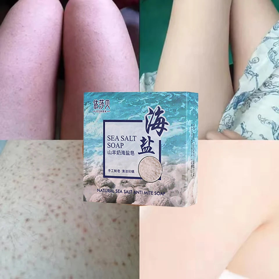 海鹽身體祛痘皂，適用於臉部、臀部、背部痘印，平滑修復雞皮，保濕美白護膚