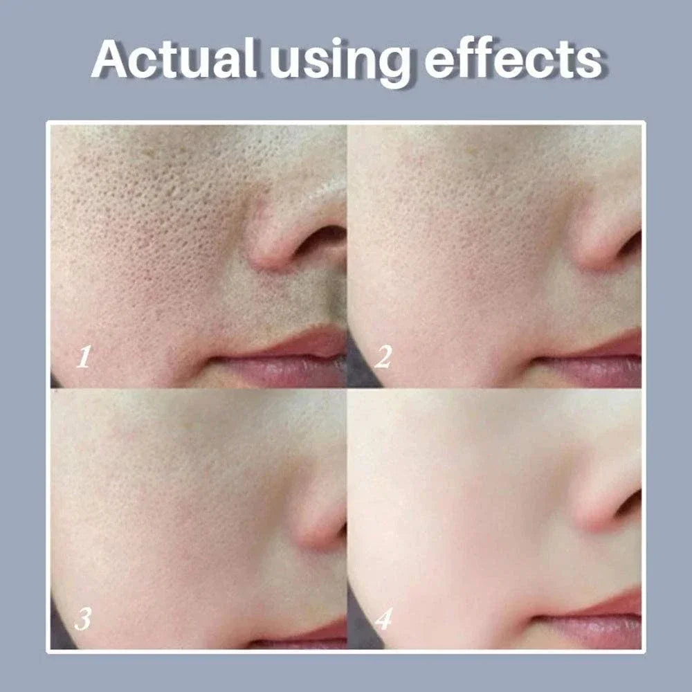Skin Texture | Pore Refining Resurfacing, Brightening Facial Serum with Retinol and Niacinamide Non-Comedogenic - Daisan Mart