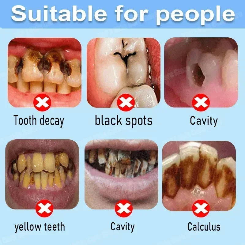Anti Decay Toothpaste repairs cavities, removes cavities, cleans plaque, whitens teeth, and freshens breath - Daisan Mart