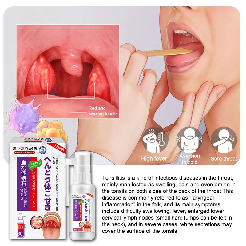 Nước Súc Miệng Tan Sỏi Amidan 30ml - Hơi Thở Thơm Mát - Daisan Mart