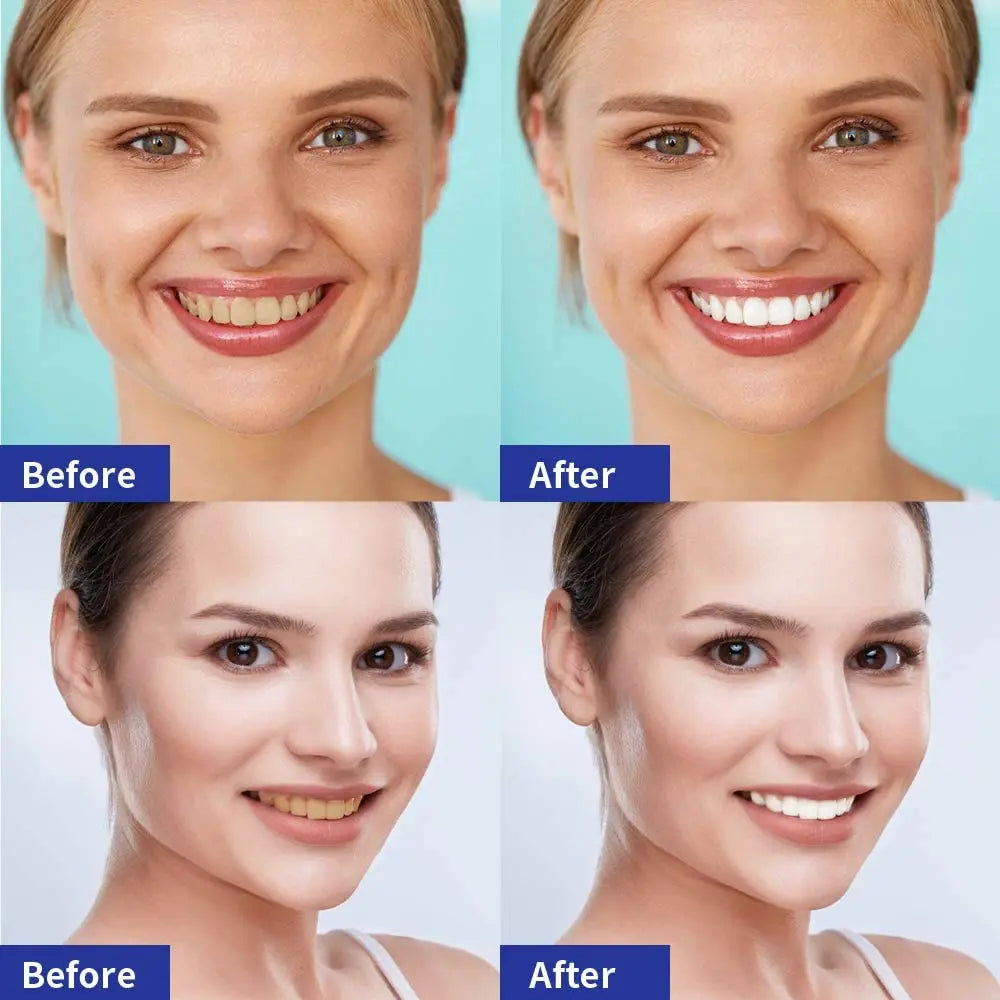 5d Gel Tooth Whitening Kit White Teeth  Strips Oral Care Kit False Teeth  Strip Dental Veneers Whitening Gel Dropshipping - Daisan Mart